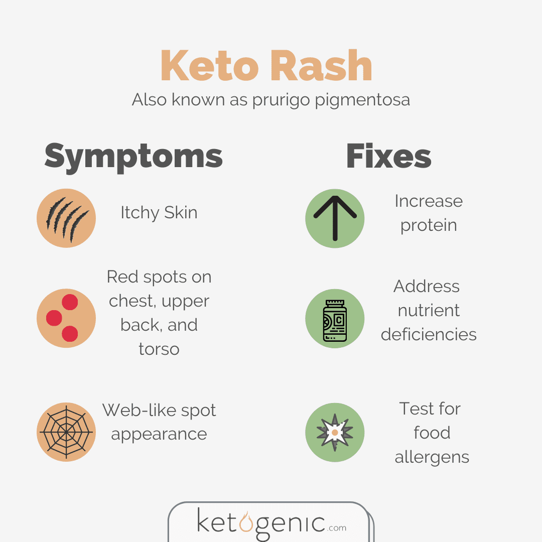 Keto Rash Symptoms